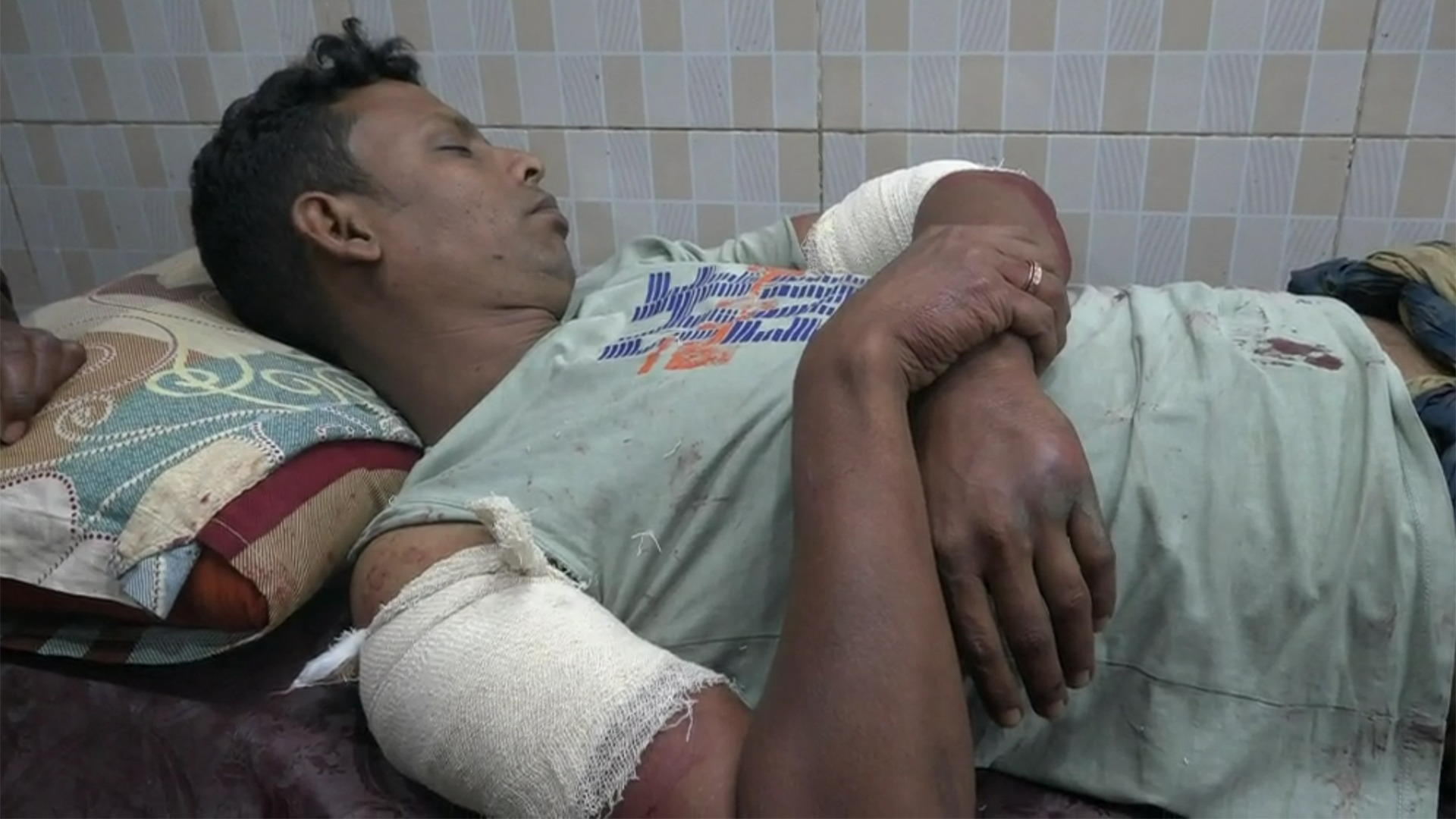 নাটোরে স্বতন্ত্র প্রার্থীর সমর্থকদের হাত-পা ভেঙে দিলো নৌকার কর্মীরা